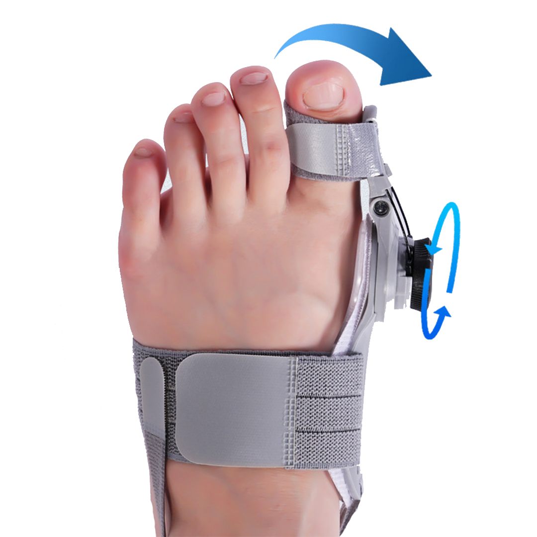 Treatmedy Bunion Fix Natural At Home Bunion Relief – Kuosn